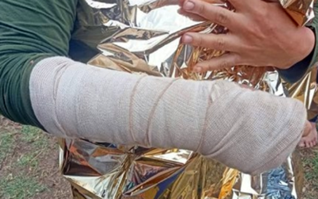 Jedna od tipičnih povreda – ženi iz Tunisa slomljena je ruka (Foto: Klikaktiv)