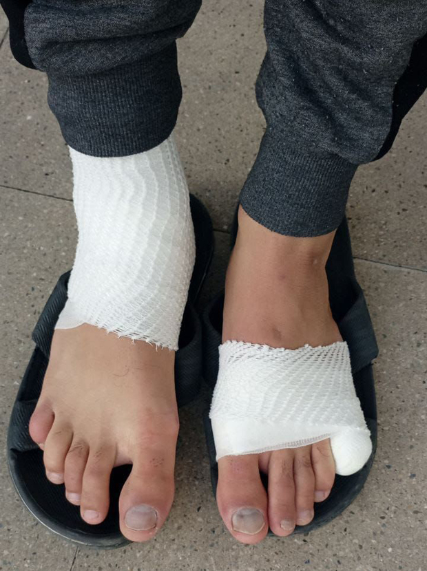 Ozljede koje su palestinske izbjeglice pretrpjele nakon pušbeka koji je nad njima provela hrvatska policija 24. marta 2024. (Foto: Bloody Borders)